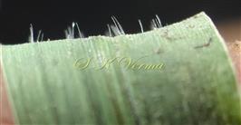  Leaf-Lower surface